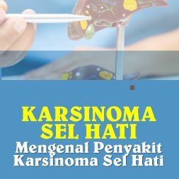 KARSINOMA SEL HATI Mengenal Penyakit Karsinoma Sel Hati