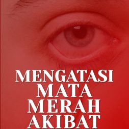 MENGATASI MATA MERAH AKIBAT IRITASI