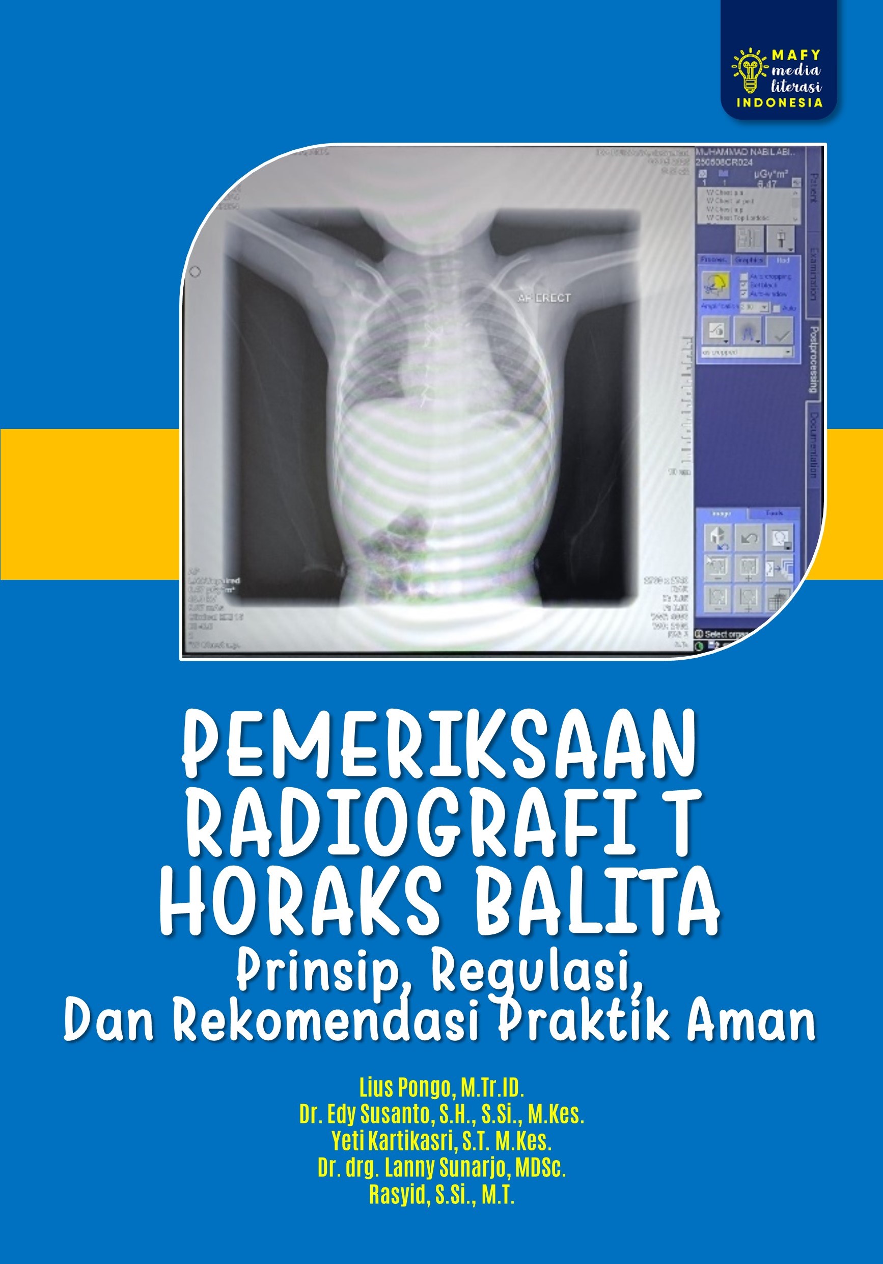 PEMERIKSAAN RADIOGRAFI THORAKS BALITA Prinsip, Regulasi, Dan Rekomendasi Praktik Aman